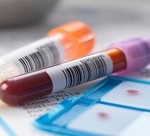 Prostatitic laboratory diagnosis
